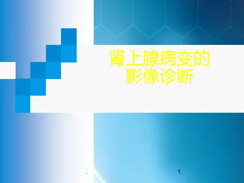 肾上腺病变影像诊断