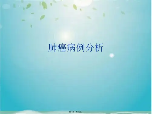肺癌病例分析(共16张PPT)