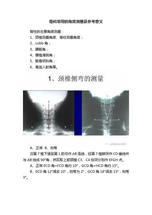 骨科常用的角度测量及参考意义