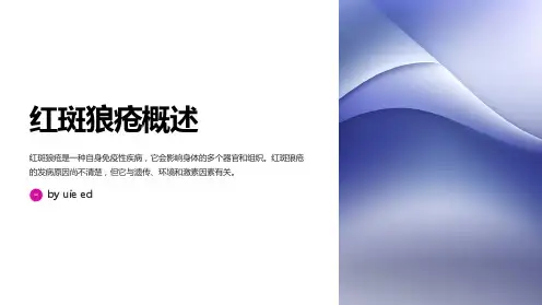 红斑狼疮的辨识与系统治疗