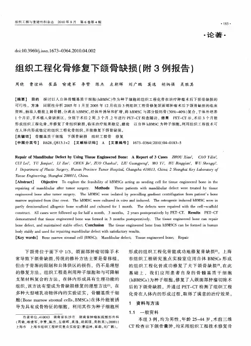 组织工程化骨修复下颌骨缺损(附3例报告)