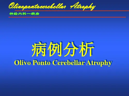 橄榄脑桥小脑萎缩OPCA