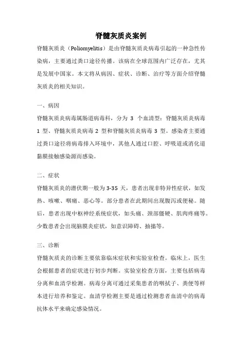 脊髓灰质炎案例
