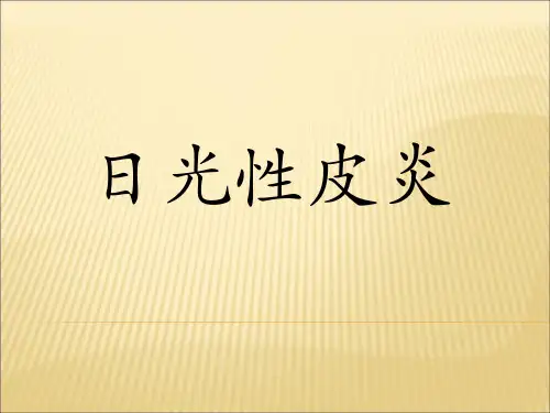 日光性皮炎 (2)