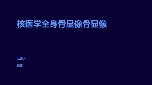 核医学全身骨显像骨显像