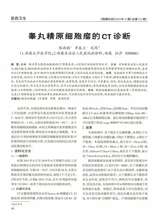 睾丸精原细胞瘤的ct诊断