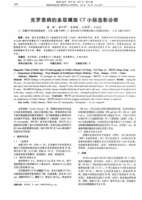 克罗恩病的多层螺旋CT小肠造影诊断