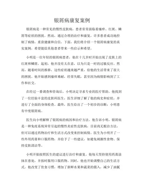 银屑病康复案例
