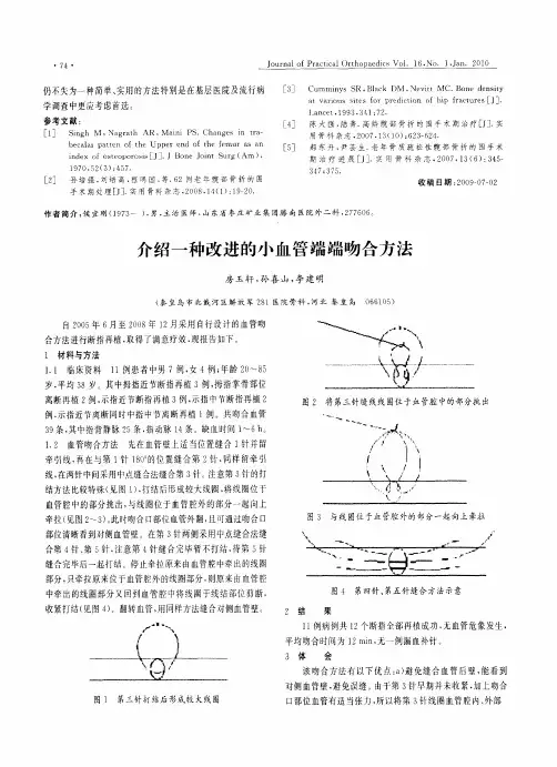介绍一种改进的小血管端端吻合方法