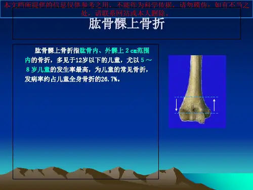 儿童肱骨髁上骨折的诊治培训课件
