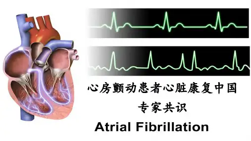 心房颤动患者心脏康复中国专家共识