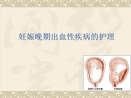 妊娠晚期出血性疾病的护理ppt课件