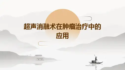 超声消融术在肿瘤治疗中的应用