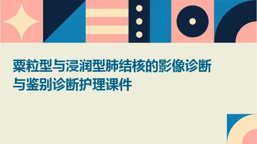 粟粒型与浸润型肺结核的影像诊断与鉴别诊断护理课件