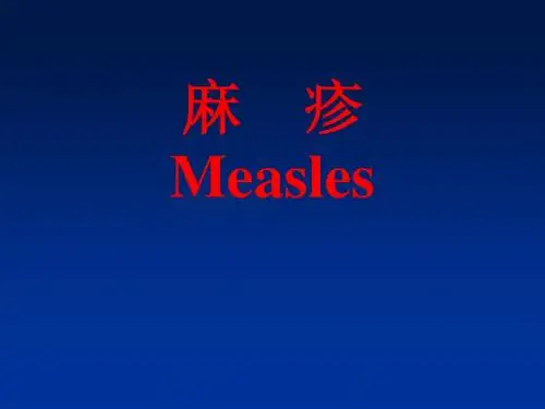 麻疹