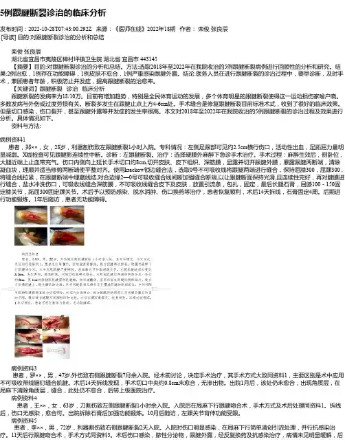 5例跟腱断裂诊治的临床分析