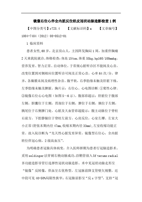 镜像右位心伴全内脏反位经皮冠状动脉造影检查1例论文
