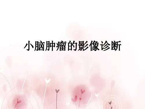 小脑肿瘤的影像诊断
