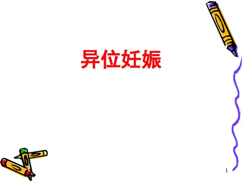 异位妊娠的护理精选参考PPT