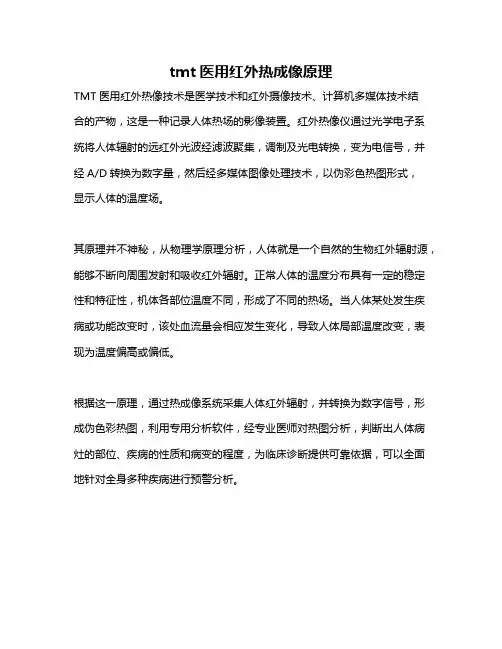 tmt医用红外热成像原理