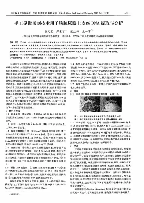 手工显微切割技术用于膀胱尿路上皮癌DNA提取与分析
