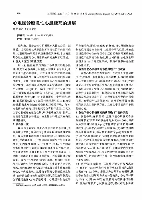 心电图诊断急性心肌梗死的进展