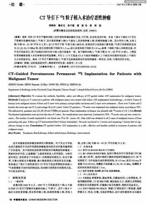 CT导引下 125I粒子植入术治疗恶性肿瘤