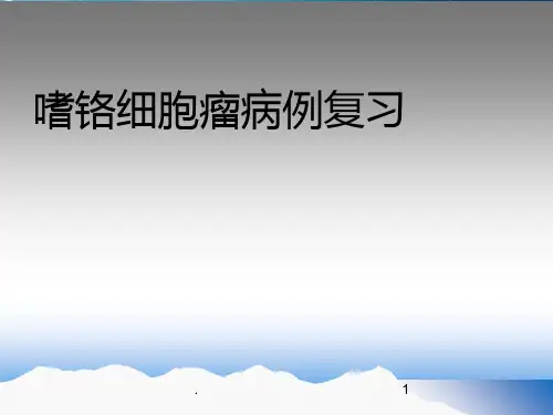 嗜铬细胞瘤病例(精)