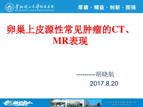 卵巢上皮源性常见肿瘤CT MRI的诊断 