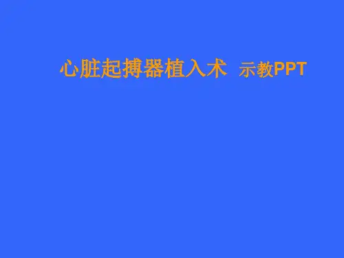 内科学：心脏起搏器植入技术简述