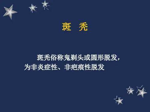 斑秃介绍课件