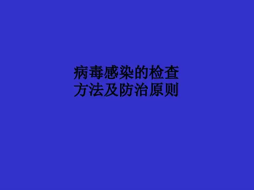 病毒感染的检查方法及防治原则课件