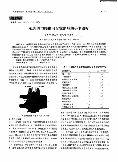 极外侧型腰椎间盘突出症的手术治疗