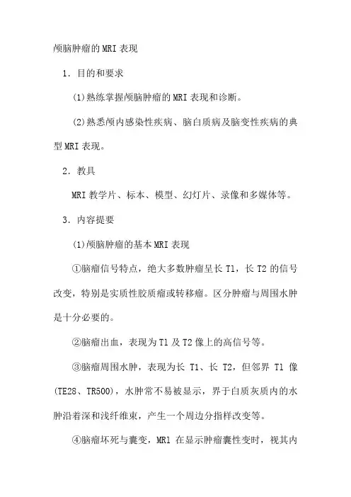 颅脑肿瘤的MRI表现