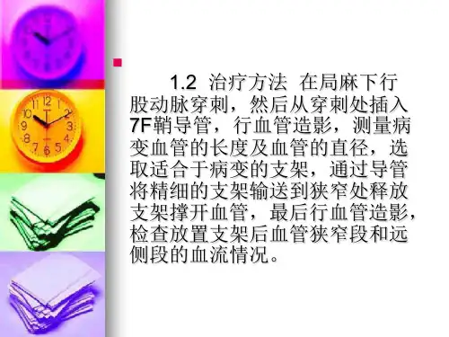 脑血管支架置入术