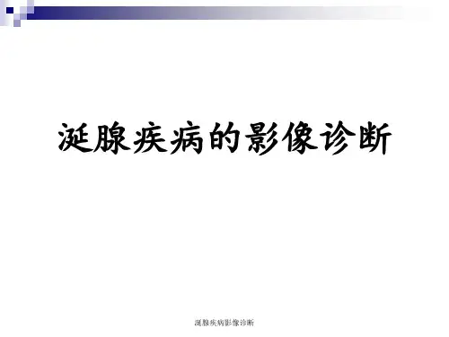 涎腺疾病影像诊断 ppt课件