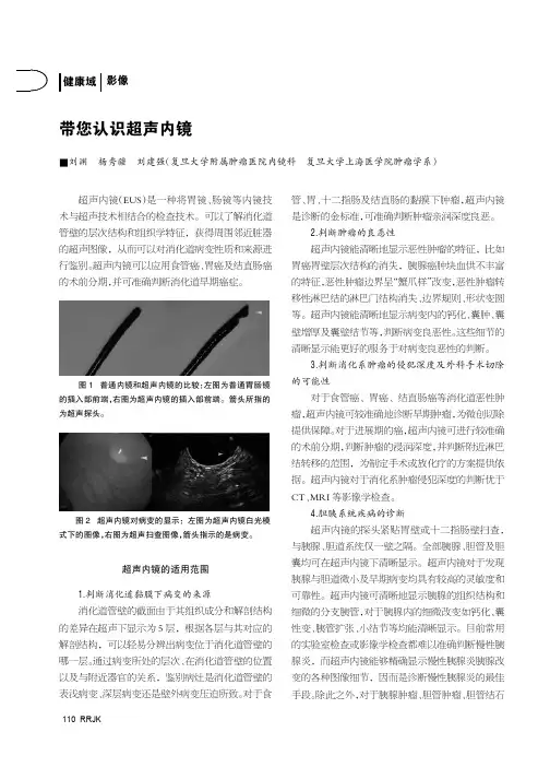 带您认识超声内镜
