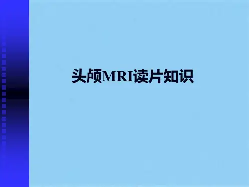 头颅MRI超好读片(共110张PPT)精选全文
