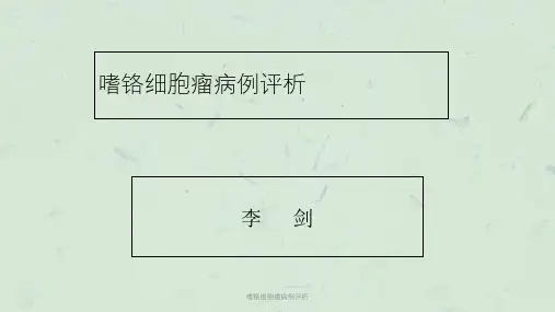 嗜铬细胞瘤病例评析课件