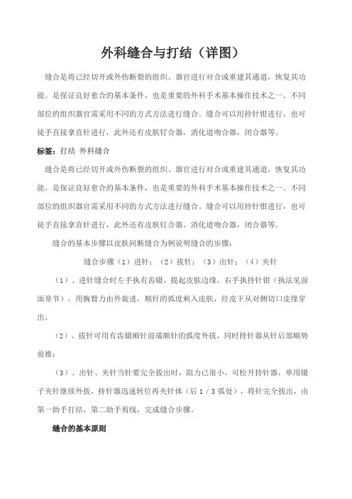 外科缝合与打结 图解 