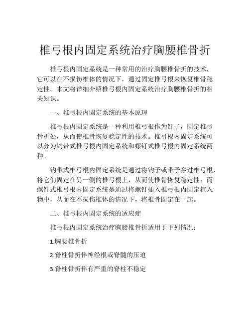 椎弓根内固定系统治疗胸腰椎骨折