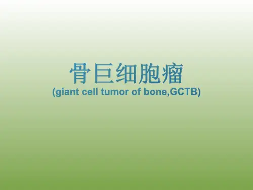骨巨细胞瘤影像诊断