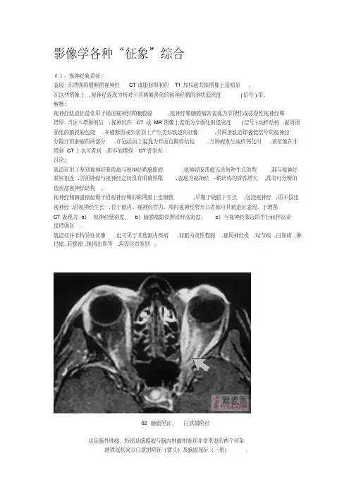 影像学各种“征象”综合