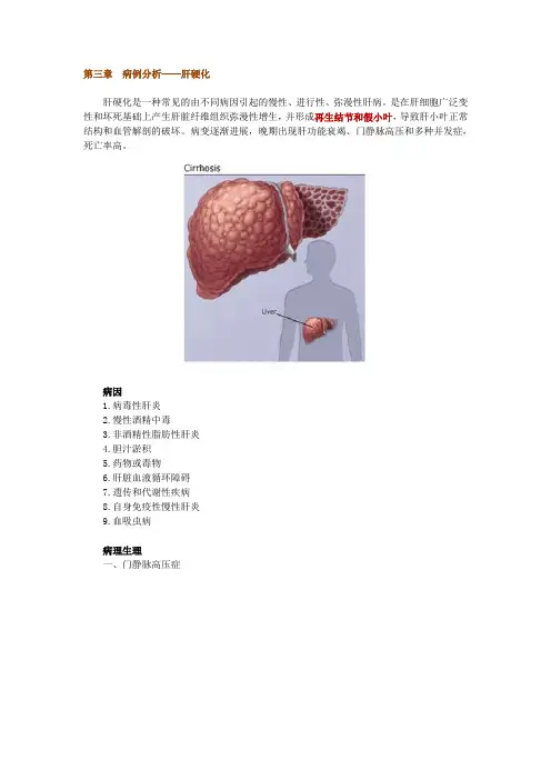 第三章 病例分析——肝硬化
