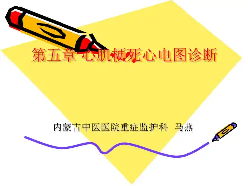 第五章 心肌梗死心 心电图