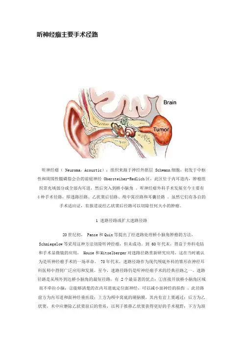 听神经瘤主要手术径路
