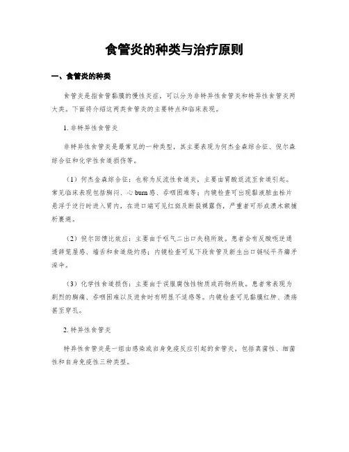 食管炎的种类与治疗原则