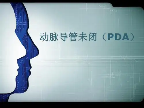 PDA(动脉导管未闭)