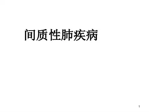 间质性肺疾病