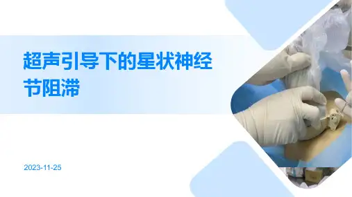 超声引导下的星状神经节阻滞